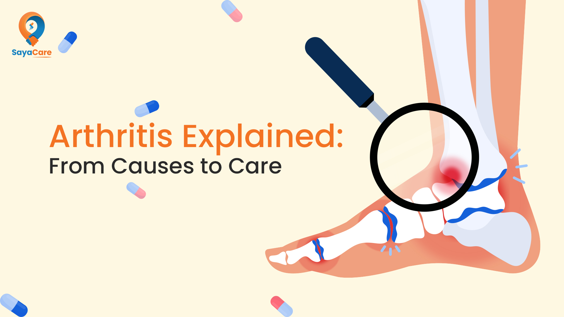 Arthritis, symptoms, its types, and more.